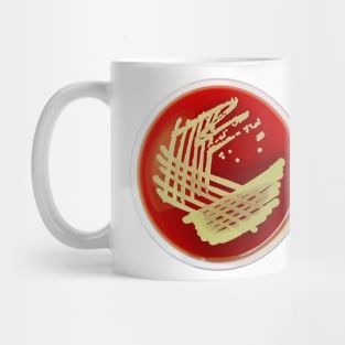 Bacterial Culture Streaks E.coli Petri Dish in Microbiology Lab Gold Red Yellow Mug